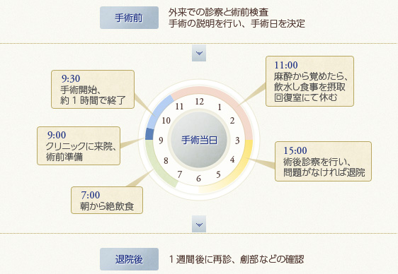 日帰り手術のスケジュール例