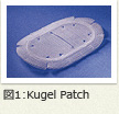 図1：Kugel Patch