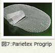 図7：Parietex Progrip
